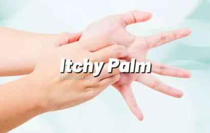 Itchy Palm – Why Do Palms Itch