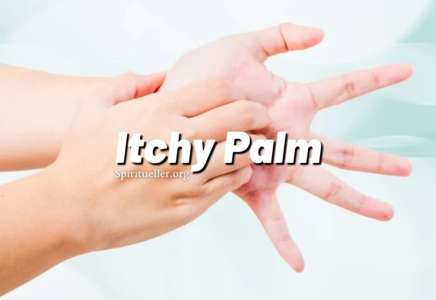Itchy Palm – Why Do Palms Itch
